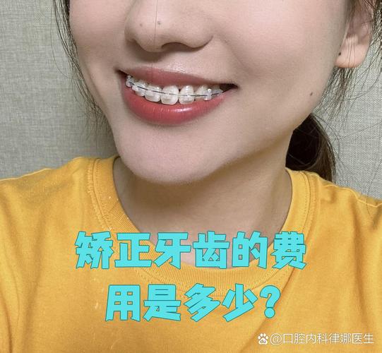 深圳纠正牙型费用全解析：矫正牙齿一般要多少钱