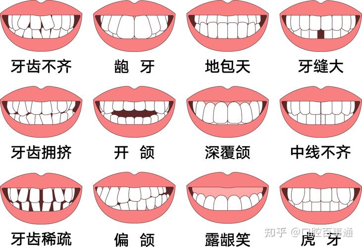深圳25岁矫正牙齿还来得及吗真实经历分享