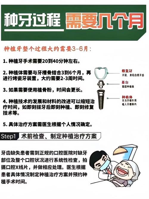 深圳半口种植牙能用多久？医生技术好能管20年