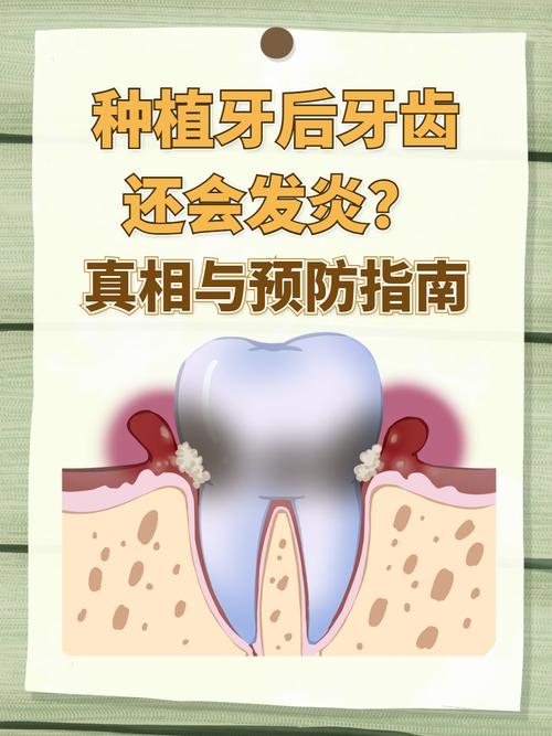 深圳种植牙严重松动发炎,什么情况需要拔除?