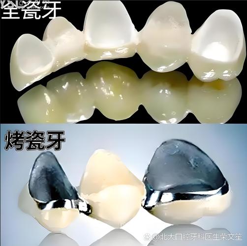 深圳现在种一颗牙到底要花多少钱