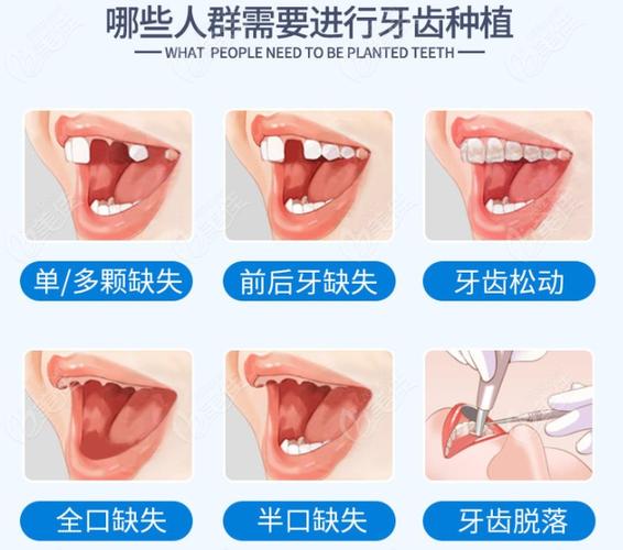 深圳保定口腔医院收费多少钱?看牙项目全解析