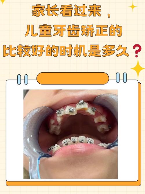 深圳8岁做牙齿矫正早不早？看情况，地包天要趁早
