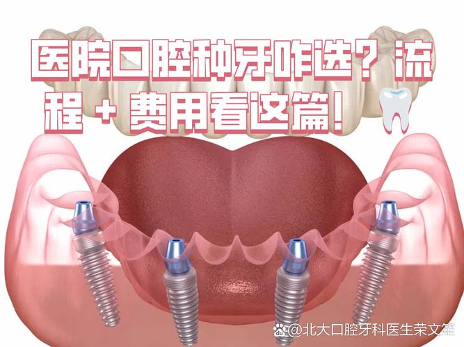 深圳连锁牙科种牙贵不贵?值不值得选?