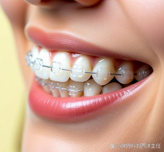 深圳隐形矫正多少钱_牙齿隐形矫正价格表深圳_福田保税区隐形矫正价格