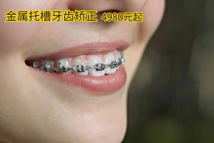 牙齿矫正要多少钱可以报销吗_牙齿矫正钱要多少钱_1颗牙齿矫正要多少钱