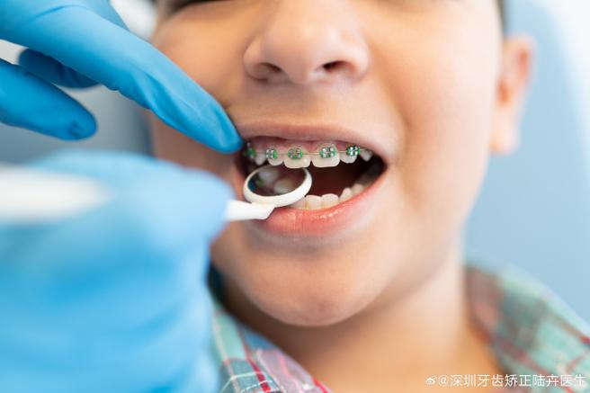 深圳8岁孩子门牙龅牙矫正方法 儿童早期干预怎么做