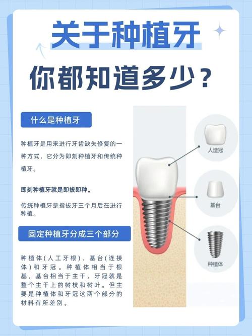 深圳4颗牙一起种到底靠不靠谱 种植医生一次性讲清楚