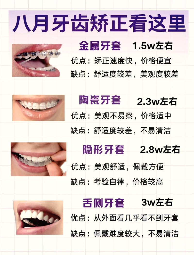 牙齿矫正地包天价钱_牙科地包天矫正器_地包天牙齿手术矫正费用