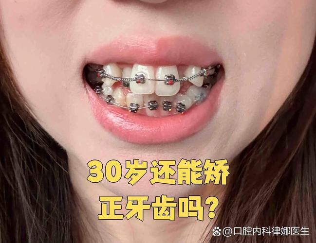 深圳成年人也能做矫正 牙齿年龄限制真相大揭秘