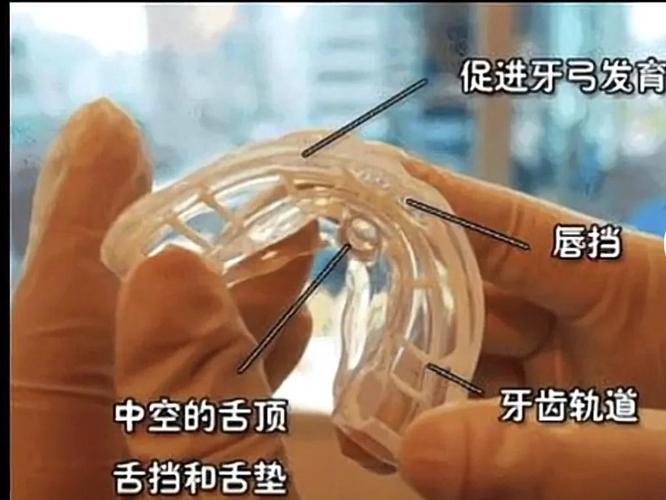 深圳南山儿童隐形MRC矫正费用到底多少钱?