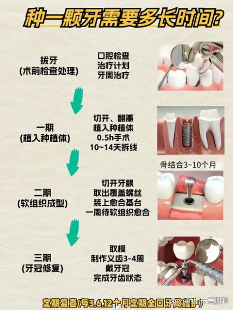 深圳种牙前做CT是必须的吗 2026种牙CT检查费用全解析