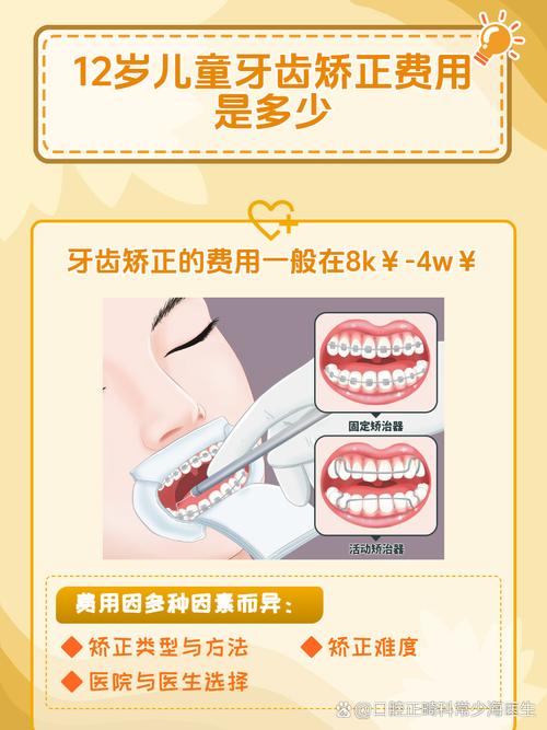 深圳12岁矫正牙齿要多少钱?医生揭秘各阶段费用明细