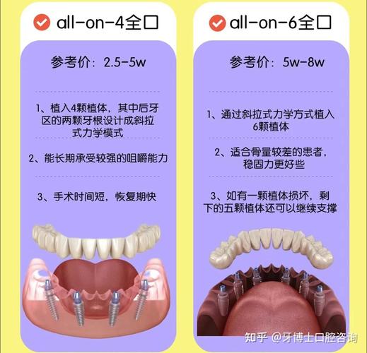 抚顺半口种植牙费用 All-on-4 技术_抚顺种牙价格表_抚顺种牙多少钱