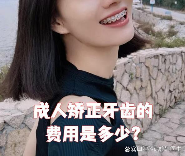 深圳龙华牙齿不齐钢丝矫正费用_深圳钢丝矫正牙齿大概多少钱_牙齿矫正钢丝价格