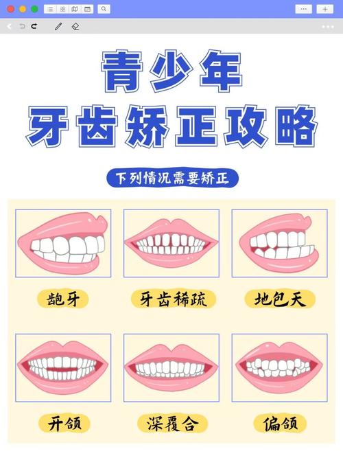 深圳15岁牙齿不齐别慌!抓住矫正黄金期,这些方法快收藏