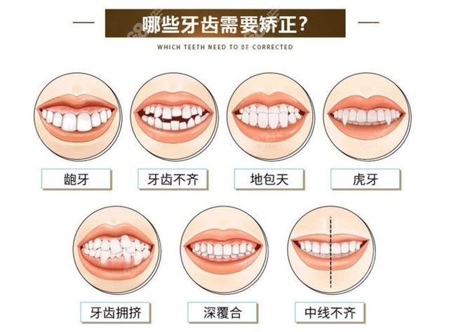 深圳38岁矫正牙齿晚不晚 别让年龄成为你犹豫的借口