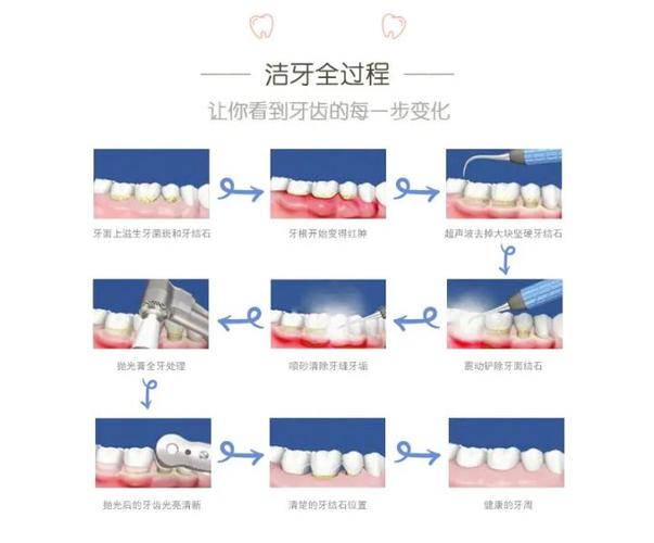 深圳宝安隐适美正品认证医院怎么选?
