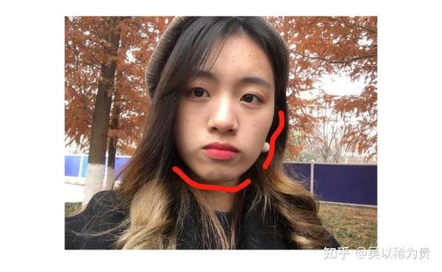 孩子正畸花了多少钱_莲塘小孩正畸费用_儿童牙齿正畸价格