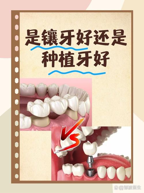 补牙镶牙种牙_补牙种牙镶牙_补牙镶牙种植牙的区别