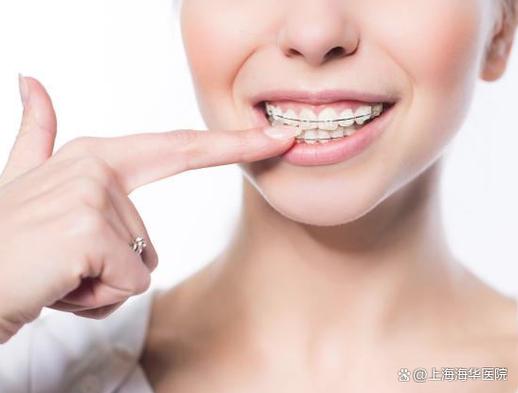 做牙齿矫正可以报医保吗_牙齿矫正的钱一次付吗_30岁可以做牙齿矫正要多少钱