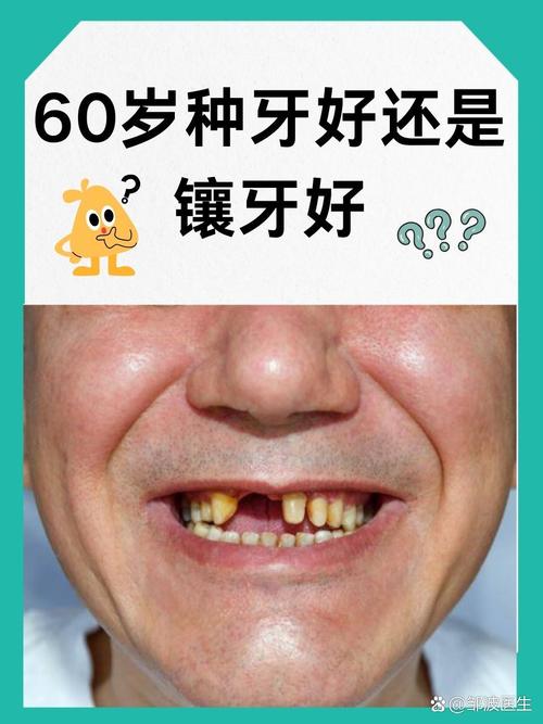 牙种可以拔吗_种牙能直接种吗_65岁可以种牙吗