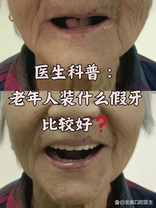 必须种牙吗_70岁有必要种牙吗_一定要种牙吗知乎