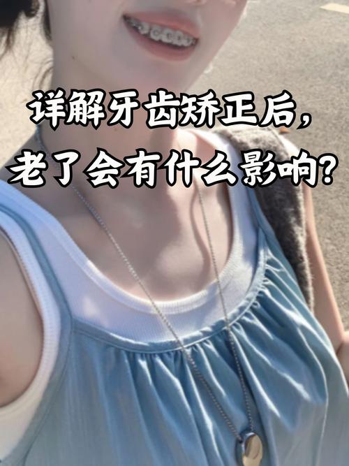 深圳40岁还能矫正牙齿吗?看完这篇文章让你了解40岁牙齿矫正的真相