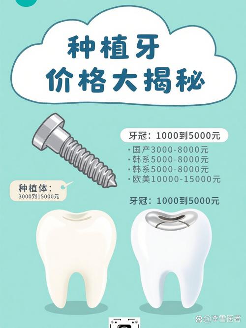 深圳奥齿泰种牙贵不贵?一颗的价格究竟是多少?看完这篇就知道!
