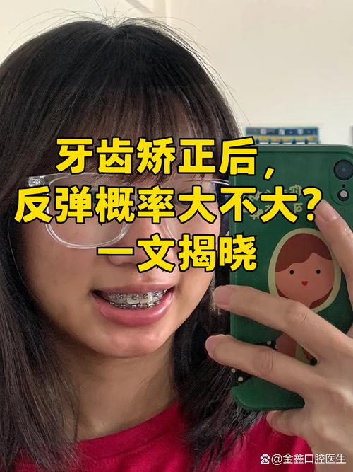 深圳19岁做牙齿矫正晚不晚 过来人告诉你真实经历